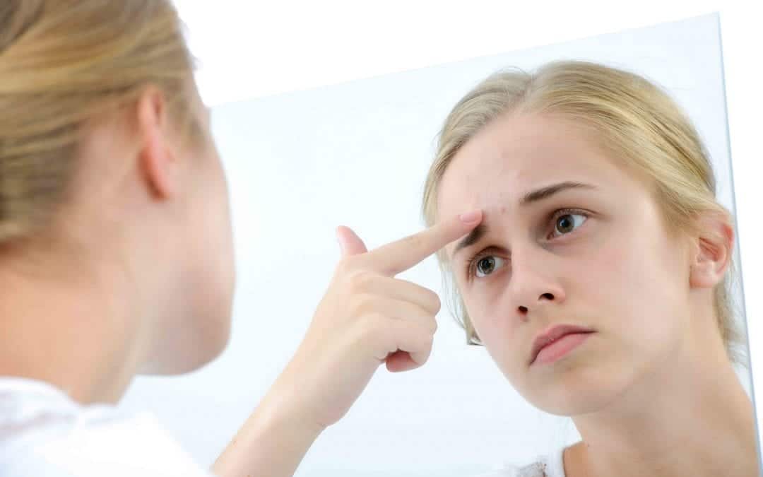 Microneedling Vs IPL: Which Treatment Works Best on Acne Treatment?